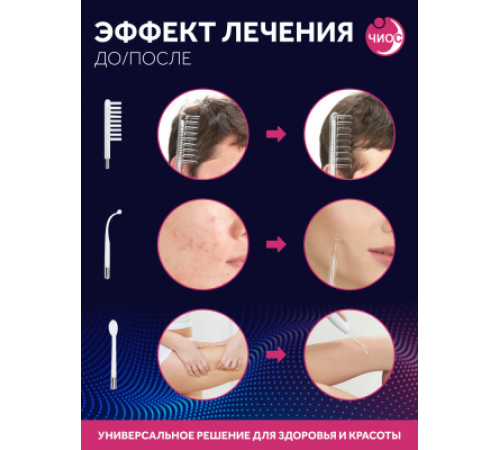 Дарсонваль массажер "Звезда" СН-100 Норма